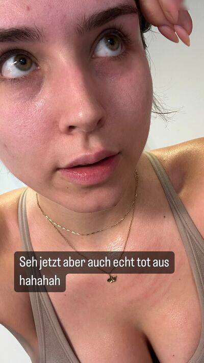 zoematthea - #7