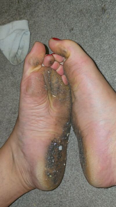 solo_toes - #10