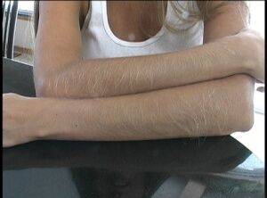 Amateur female Lori Anderson displays her really hairy arms on picsofsex.com